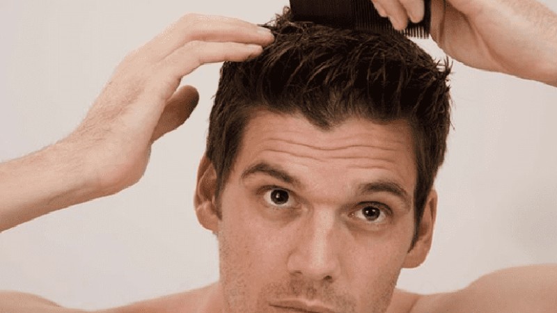 Tóc nam khô cứng khiến cho bạn cần phải dưỡng tóc kỹ càng hơn